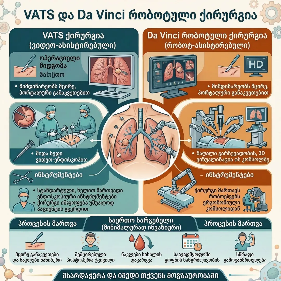 MPGCare Medical Park VATS ქირურგია