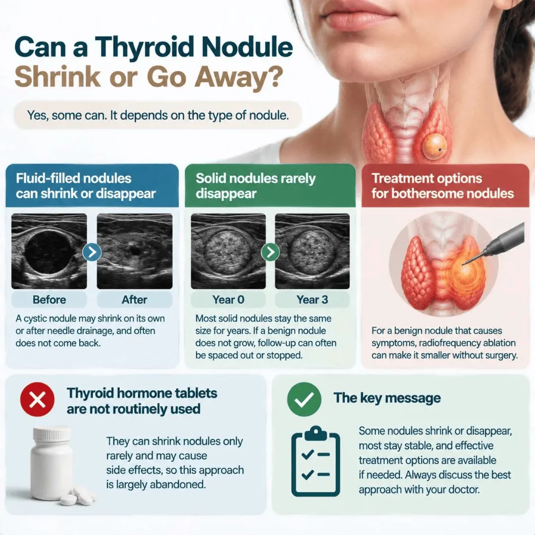 Can thyroid nodules go away