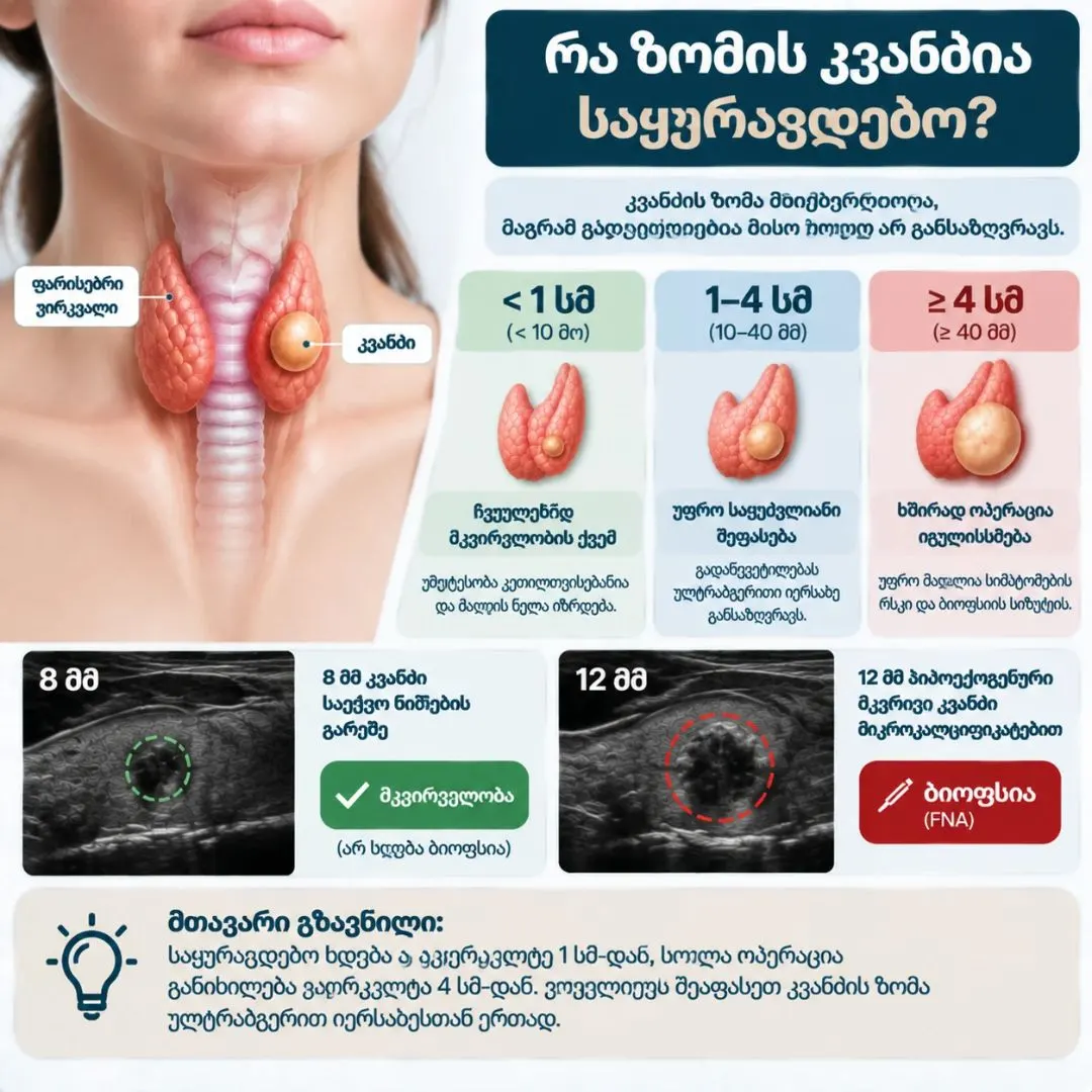 საყურადღებო კვანძის ზომა